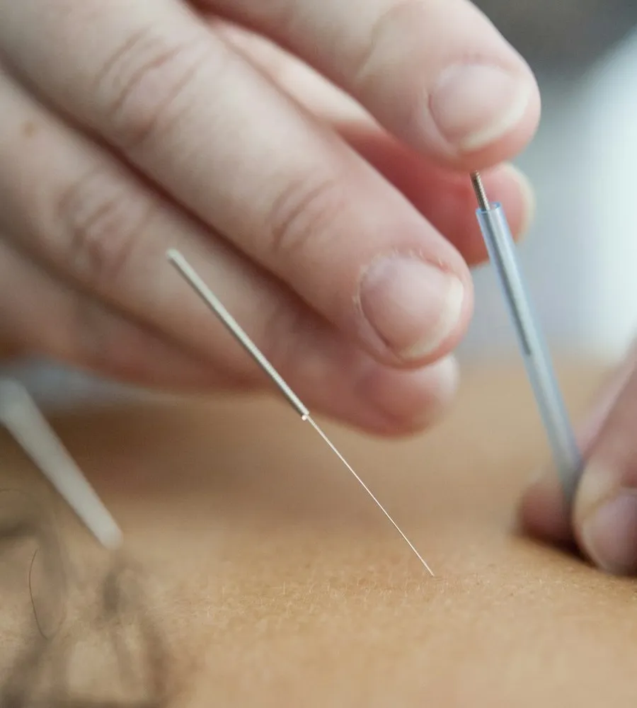 Técnica de Acupuntura Tung, uno de los cursos que se imparten en Mérida