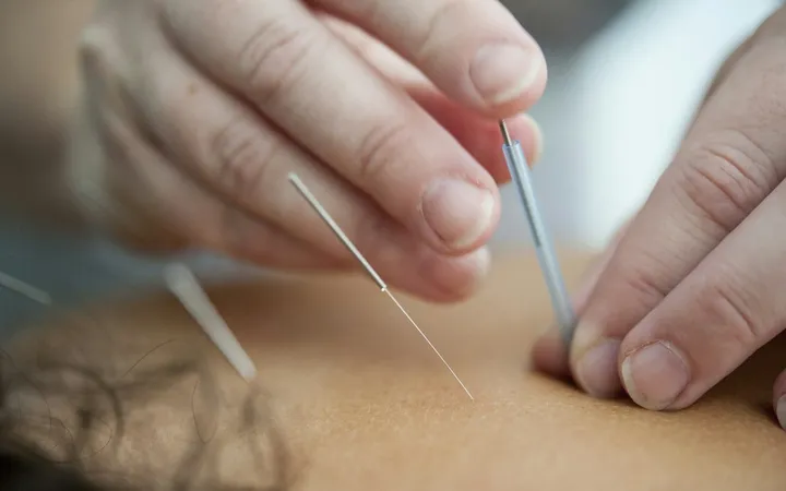 Técnica de Acupuntura Tung, uno de los cursos que se imparten en Mérida
