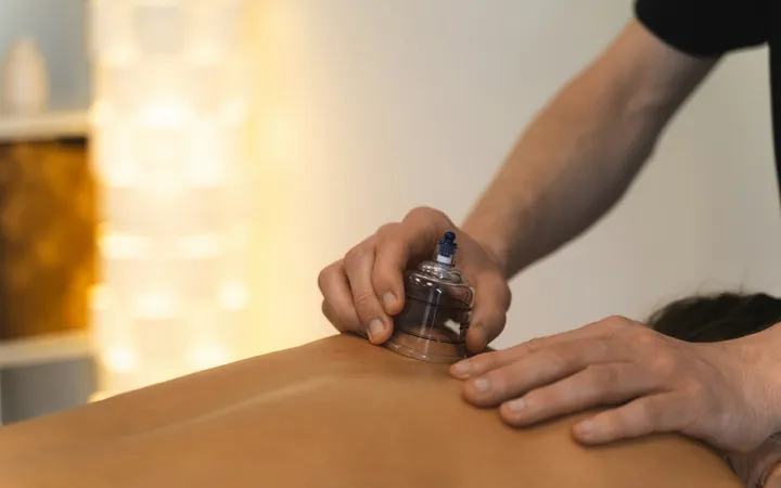 Técnica de Cupping y Moxibustión, uno de los cursos que se imparten en Mérida